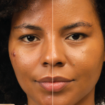 Tinta Humide Healthy Foundation MONTOC